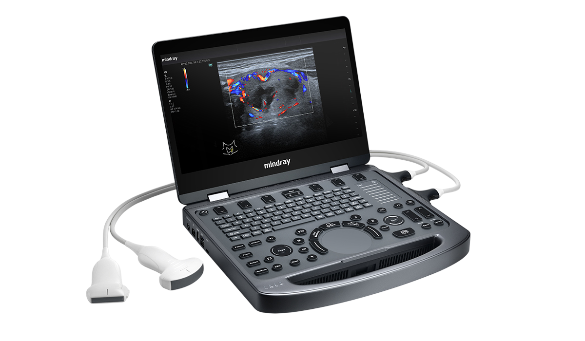 Sistema de Ultrasonido Compacto MX5 – Mindray