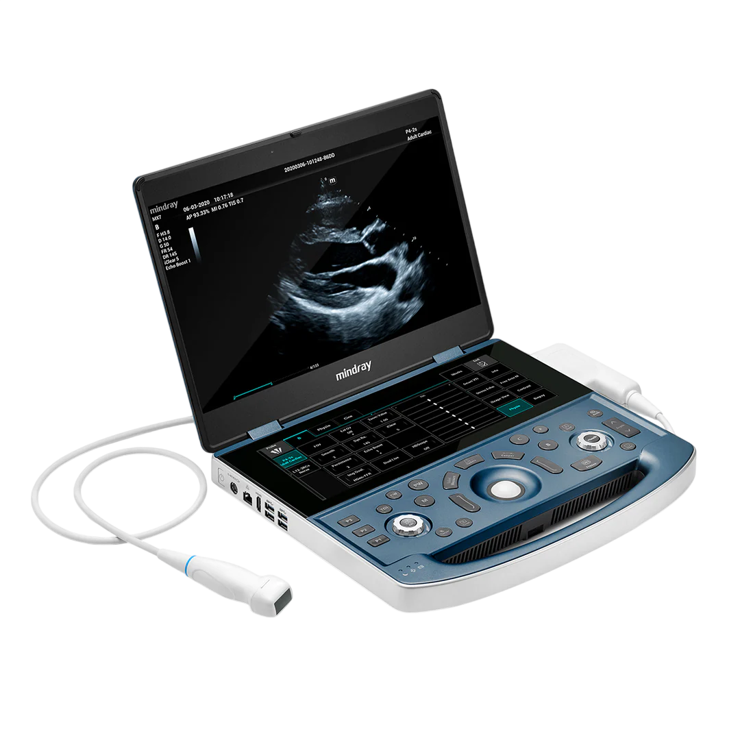 Sistema de Ecografía Portátil MX7 – Mindray