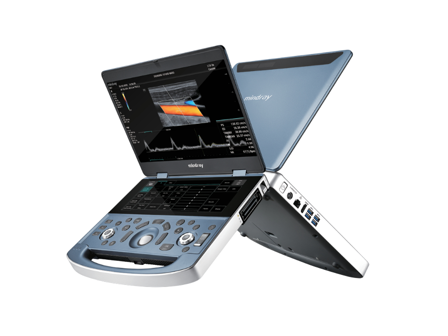 Sistema de Ecografía Portátil MX7 – Mindray